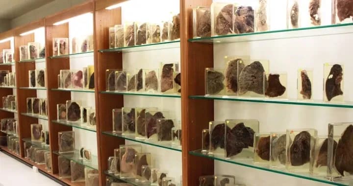 The Pathology Museum holds a unique collection of 3500 human body specimens